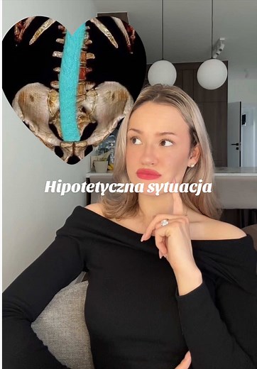 Hipotetyczna sytuacja — quiz medyczny o perforacji jelita
