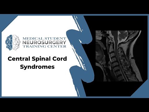 Central Spinal Cord Syndromes