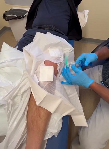 I tried the Synvisc One injection Treatment - part 3