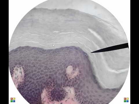 thick skin histology.avi