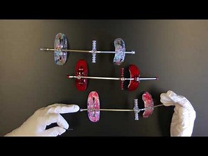 Orthodontic Multi-Adjustable Facemasks | Ortho Technology