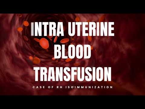 Intrauterine Transfusion (IUT) – Real Case Explained | Fetal Medicine
