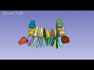 Tooth Segmentation from CBCT Scans Using Dentition-Based Learning