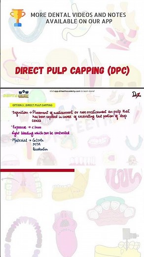 Direct Pulp Capping (DPC)