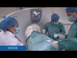 Microwave ablation of GGO (Ground Glass Opacity) in the lung--by Dr. Xin Ye