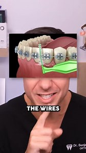 A surprisingly smart way to clean around braces | TheBentistofficial