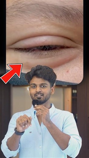 Why Your Eye Twitching Happens 😳 | Eye Twitch Explained | #Shorts #tamil #health