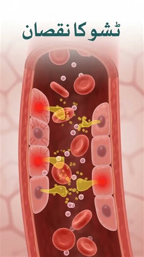 What is SGOT / AST (Serum Glutamic Oxaloacetic Transaminase)