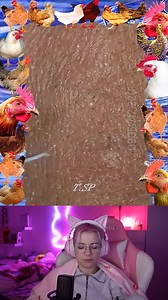 5.8K views · 106 reactions | Relaxing Time 殺 | Pimple Popping | Facebook