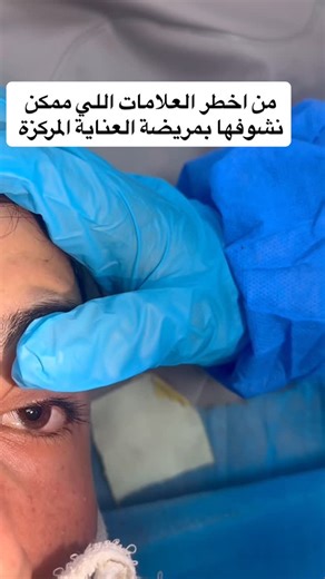 ‎تقني تخدير |عــذراء حامــــد‎ on Instagram‎: "من أخطر العلامات السريرية اللي ممكن تنلاحظ بمريض العناية المركزة، هو توسّع البؤبؤ (Dilated pupil) مع عدم تفاعله للضوء (Non-reactive to light). هالحالة تعتبر نذير سوء (Poor prognostic sign). وغالبًا ترتبط بضرر شديد بالجهاز العصبي المركزي. عدم استجابة البؤبؤ يدل على خلل بوظيفة جذع الدماغ (Brainstem dysfunction). وممكن يكون مؤشر متقدم على توقف النشاط العصبي. خصوصًا إذا كان ثنائي الجانب ومستمِر. هالعلامة تُشوف بحالات ارتفاع الضغط داخل القحف (Raised ICP)