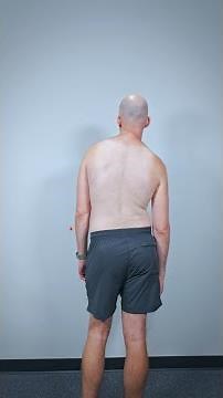 Lateral Pelvic Tilt