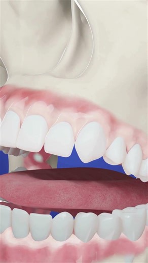 Inside an Oral Cancer Screening
