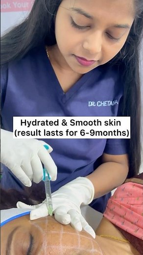 Skin booster| #hyaluronicacid#skinvive#juvederm#skinbooster#smoothskin#hydration#skincare#injection