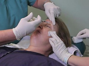 Botox Preparation and Injection Technique