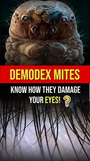 What Are Demodex Mites? And How Can They Affect Your Eyes?