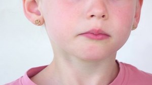 Little Girl Show Tongue Throat Child Stock Footage Video (100% Royalty-free) 1079994905 | Shutterstock