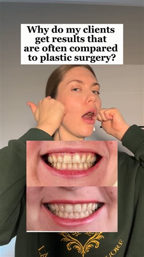 Non-surgical Facelift | Anti-aging | Posture | Jaws on Instagram: "Why do my clients get results that are often compared to plastic surgery? ⠀ Because we don’t chase quick fixes. And we don’t try to erase what has been forming for years in 10 sessions with a therapist. ⠀ The body is a very intelligent system. When tension, trauma, or imbalance appears, it adapts — through asymmetries, compensations, and shifts. ⠀ And to truly realign this system, it’s not enough to simply “relax something locall