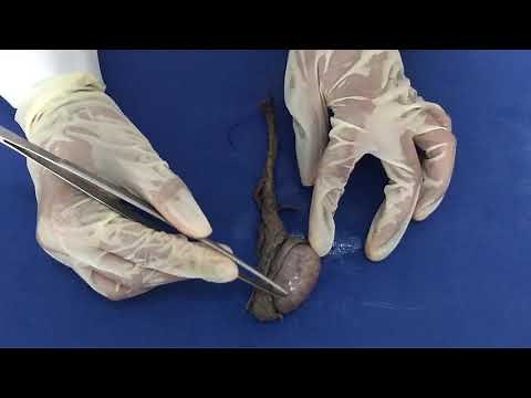 Anatomia do Testículo, Epidídimo e Ducto Deferente