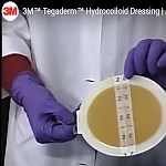 Hydrocolloid Wound Dressings Instructions - MedView Systems