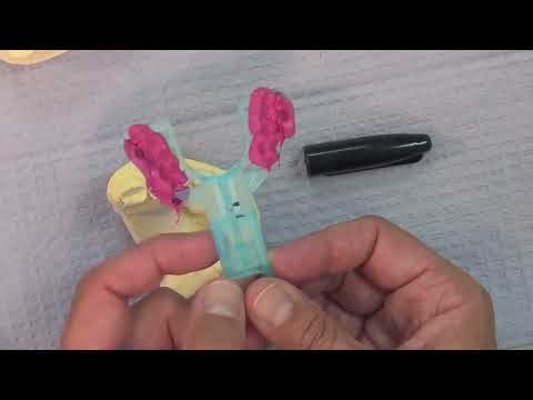 É MUITO FÁCIL FAZER O DISPOSITIVO PARA APNÉIA OBSTRUTIVA DO SONO E RONCO. É leve, sem cola sem BPA