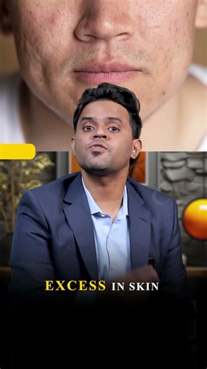 How to treat under-eye dark circles? | #draneeshsuresh