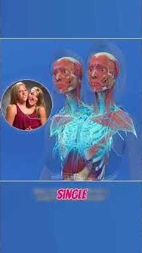These people were born stuck together.