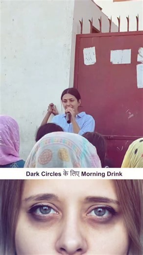 𝕊𝕦𝕞𝕚𝕥 𝕍𝕒𝕥𝕤 | Dark Circle Home Remedy | Instagram
