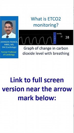 What is ETCO2 monitoring?