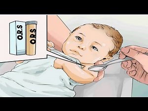 Dehydration and Fluid therapy | Pediatric