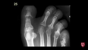 MSK Boards Prep: 50 Real Life Cases