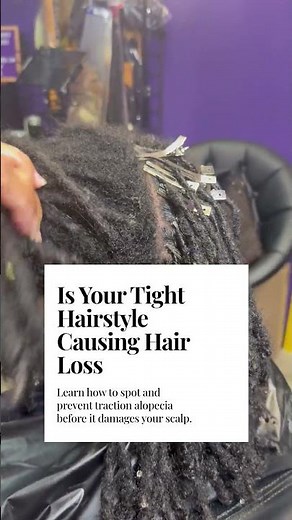 Understanding Alopecia in African American Hair