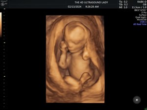 girlfriend is 15 weeks old, sitting cross legged, and sucking her fingers 🥰 | The 4D Ultrasound Lady