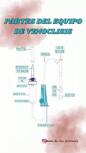 Todo sobre Venoclisis: Equipos y Procedimientos en Enfermería