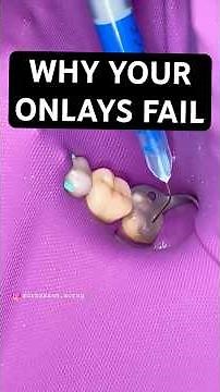 Why Your Onlays Fail 😳 Rubber Dam & Cementation Protocol Explained