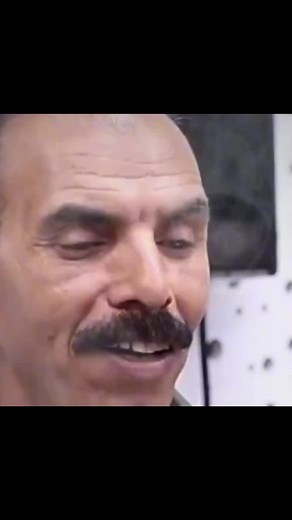 Understanding Baldness and Facial Hair Trends