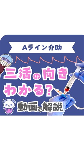 ぱん🐼麻酔の看護師 on Instagram: "Aライン介助、詳しくは👇 ＼コラボ投稿です／ 【麻酔の看護師】 ぱん @pan_masui_kango 【手術室看護師】 しゅがー @sugar.openurse 🌟Aライン介助の流れ🌟 ①穿刺 ②コネクターを繋ぐ ⚠️ペアンを使う時は上から把持！ ↓ ③エア抜き ⚠️三活はボトル側をOFF！ ↓ ④逆血確認 ↓ 先生と一緒に確認！ 「逆血あります。返血します！」って声をだすよ📢 ↓ ⑤ゆっくり返血 ⚠️刺入部も確認！ ↓ ⑥波形の確認 ⚠️三活はシリンジ側をOFF！ ↓ ⑦へパ生をフラッシュ 💡三活は患者さん側をOFF→トランスデューサーのつまみを引っ張る→シリンジが満たされる→三活はボトル側をOFFにして返血 ⚠️エアが入らないように、ゆっくり返血するよ！ ⚠️血液が見えなくなるまで繰り返す。 ↓ ⑧テープ固定 ⚠️針の角度を保ってね。 ⚠️波形も確認しながら固定するよ！ ※一例です。各施設のマニュアルや方針に従って下さいますようお願いいたします。 ※動画中に登場した物品は全て私物です。 ※看護ケアを行う際は、各施設のマ
