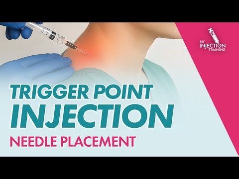 What Providers Should Know About Trigger Point Injection Technique