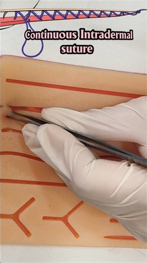 Continuous Intradermal suture #youtubeshorts#shorts