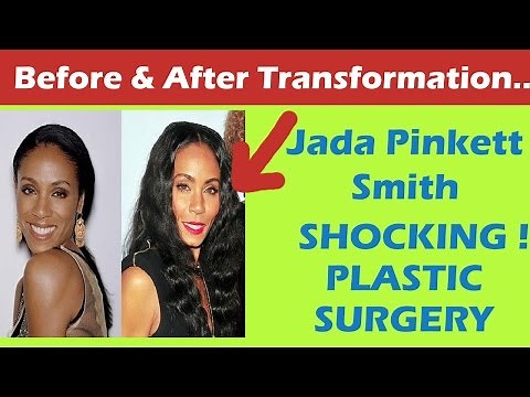 Jada Pinkett Smith Plastic Surgery Before and After Full HD