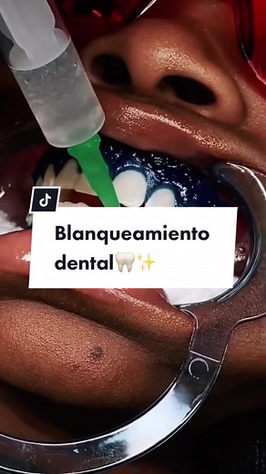 Ig: daniferminb 🦷✨