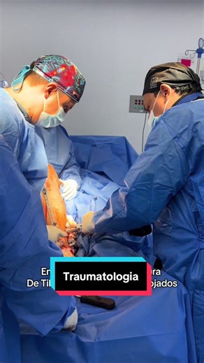 En caso de una fractura de diafisis(parte central de hueso) de tibia colocamos un clavo Intramedular con tornillos Encerrojados (evitan la rotación) para que la fractura consolide (pegue) y el paciente camine progresivamente #traumatologia #medico #doctor #cirugia #medicina