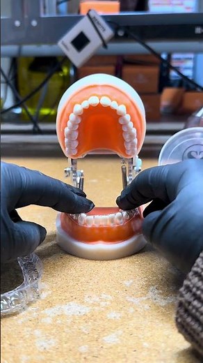 How should a retainer fit