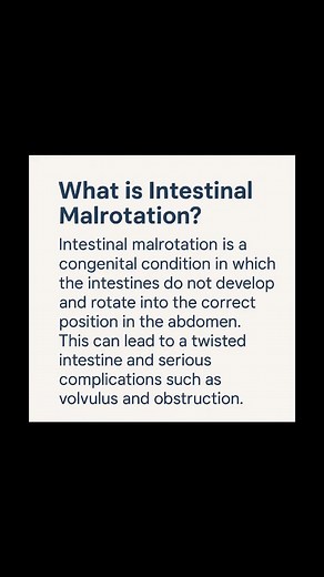 Understanding Intestinal Malrotation and Volvulus Risks
