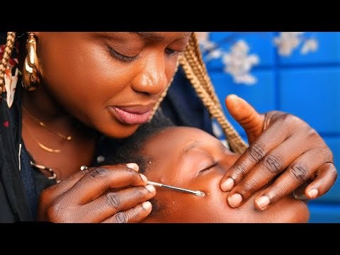 ASMR✨rare & Super attentive nitpicking,Face,nose, head & hand picking hair crust,soft gum cracks