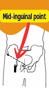 Mid inguinal Point #abdomenanatomy #inguinalhernia