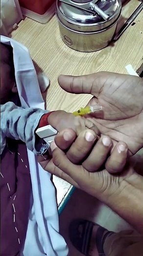 How to Pass IV Line in a 1-Month-Old Baby | Pediatric IV Cannulation Guide