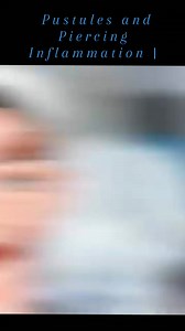 ASMR Removal and Cleaning of Pustules and Piercing Inflammation | #animation #reel #reelsviralシ #treatment #asmr #cleaning | Akhilesh Yadav