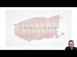口腔内スキャナーのトラブルシューティング