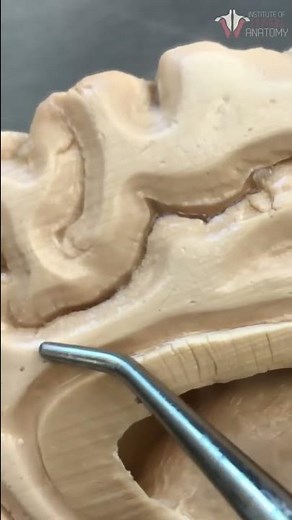 Inside a REAL Human BRAIN