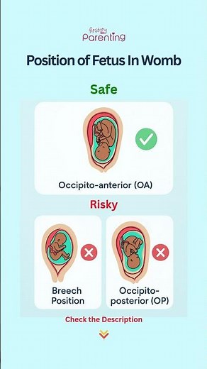 Position of Fetus in Womb | Safe vs Unsafe Baby Positions | Fetus Position in Womb